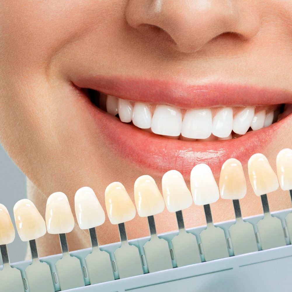 smiling-young-woman-cosmetological-teeth-whitening-dental-clinic-selection-tone-implant-tooth (1)